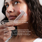 4-in-1 Red Light Therapy Wand & Activating Serum Kit Solawave