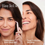 4-in-1 Red Light Therapy Wand & Activating Serum Kit Solawave